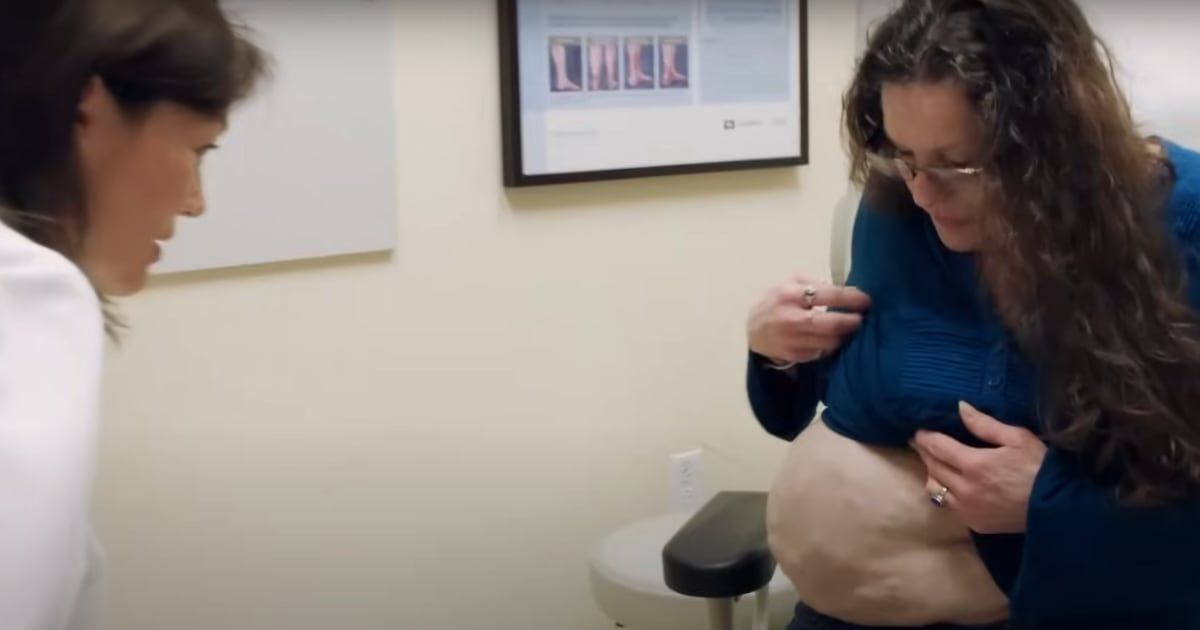 'Take My Tumor' Episode 5 follows the journey of Jennifer who has a tumor on her stomach (YouTube/@TLC)