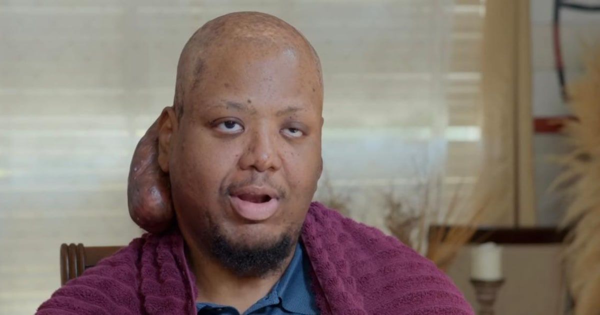 'Take My Tumor' patient Arlin shares close bond with his mother (Instagram/@tlc)