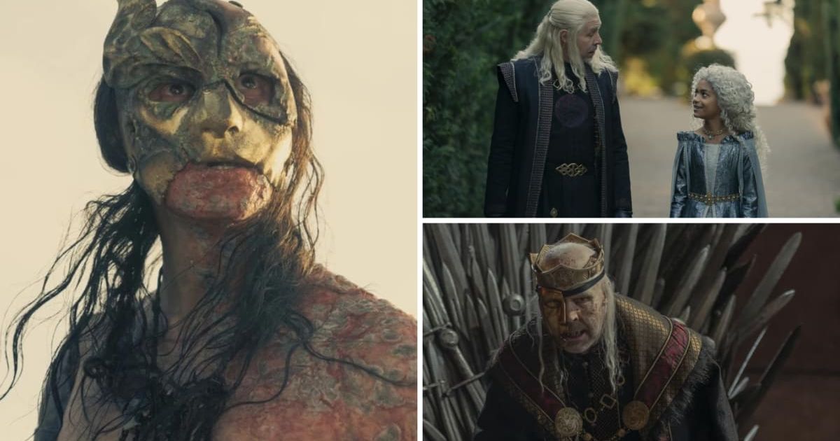 'House of the Dragon' aggressively pushes the boundaries of graphic content with its gross visuals (@hbo)