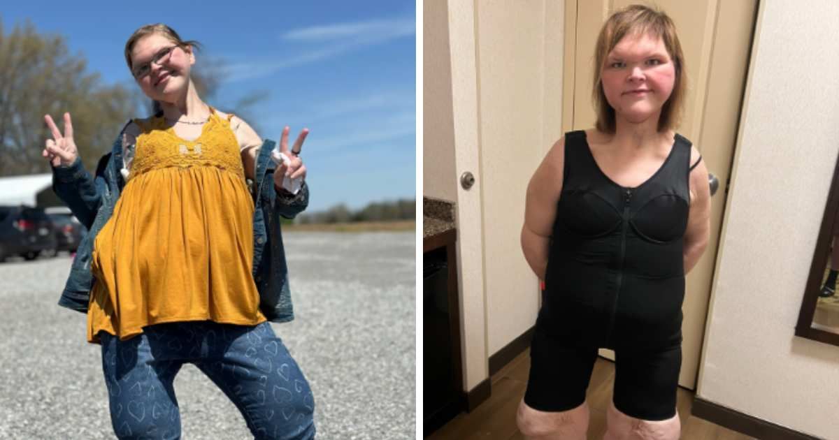 (L) A still of Tammy Slaton from her TikTok video; (R) A still of her in black shapewear. Cover Image Source: (L &R) TikTok | @tammy.l.slaton
