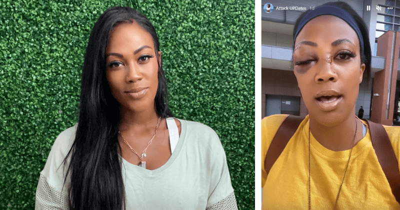 Olympic medalist Kim Glass shares horrifying pics after being attacked by homeless man in LA