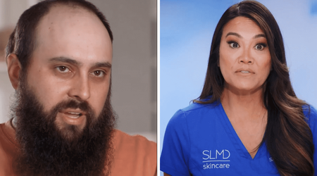 Where is Mike now? 'Dr Pimple Popper' patient wanted to get rid of head bump before 2 major life events