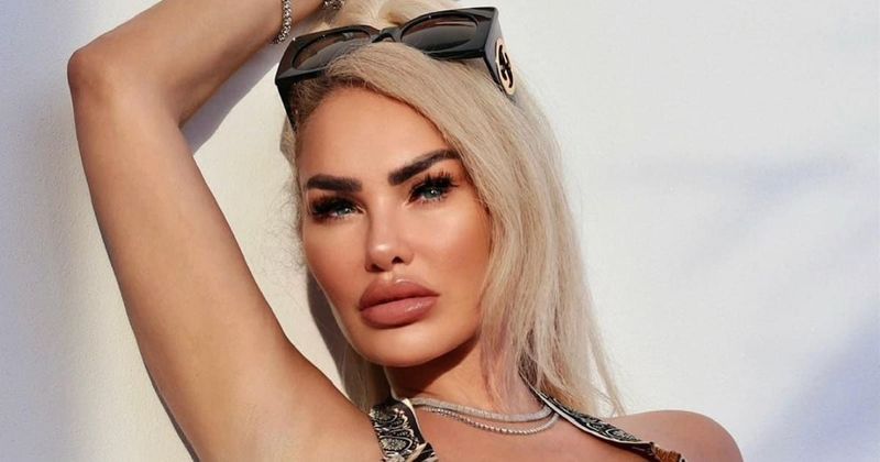 Internet begs '90 Day Fiance' star Darcey Silva to stop promoting weight loss pills as she shares 'botched lip' filter video