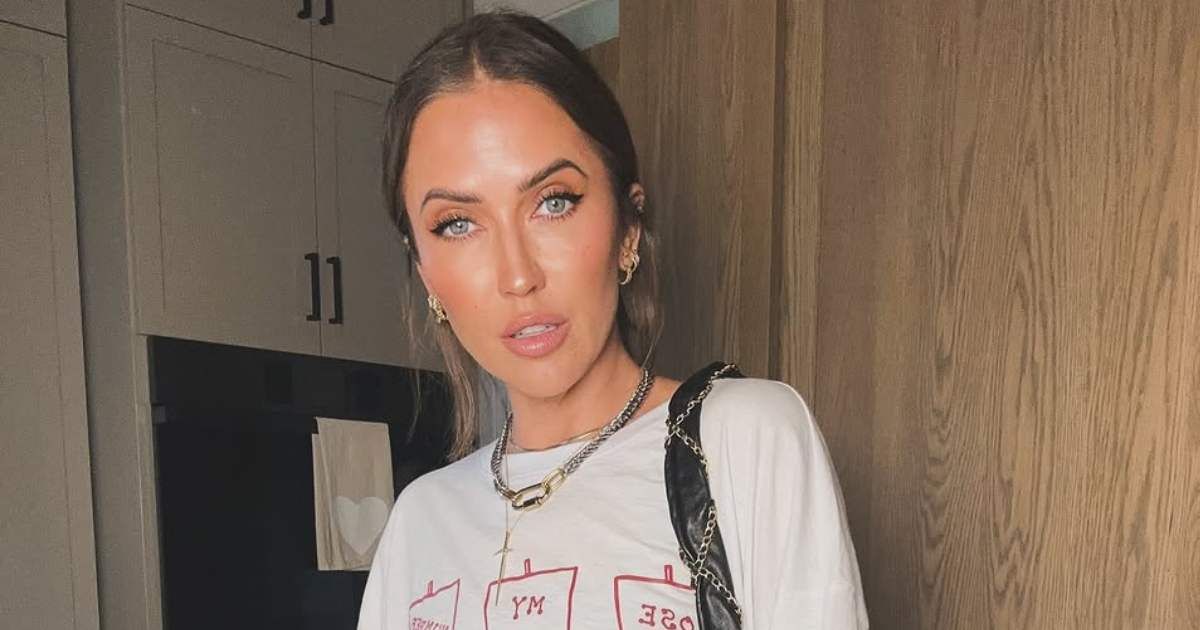 'The Bachelorette' star Kaitlyn Bristowe flaunts fresh look after cosmetic procedure