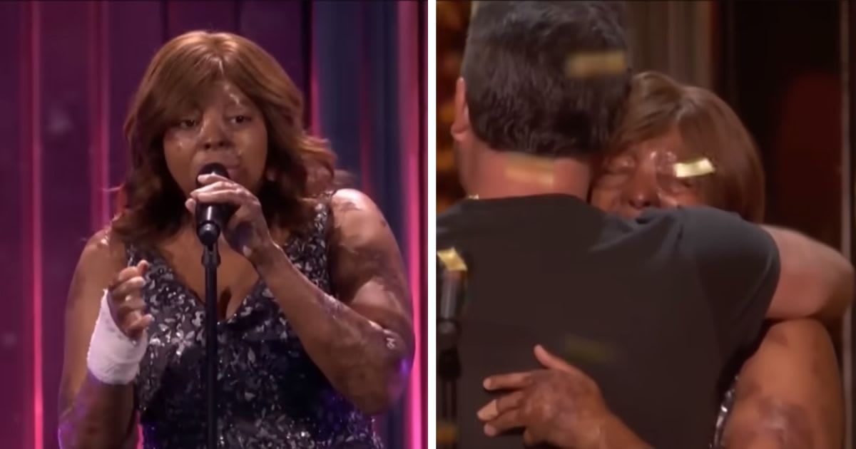 After surviving 100+ surgeries from a plane crash, she returned stronger — and sang her heart out on ‘AGT’