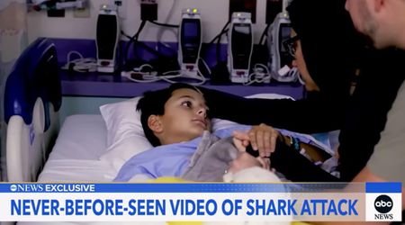 Family Releases Footage of Shark Attack on 10-Year-Old Son While Snorkeling In Florida