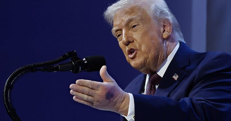 White House addresses visible bruise on Trump’s left hand after Davos event