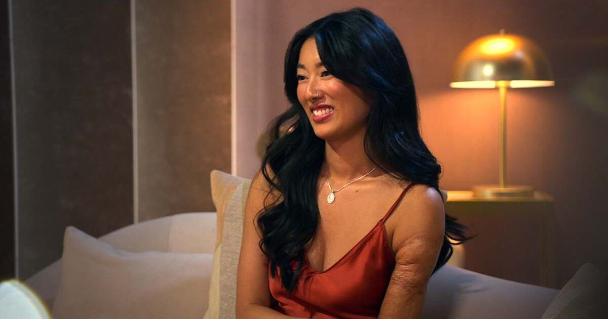 What happened to Emma's arm?  ‘Love Is Blind’ Season 10 contestant explains how she got the scars: ‘I had…’